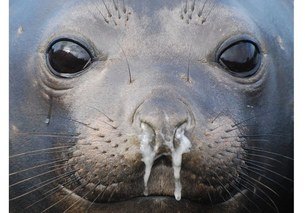 runny nose