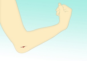 cut