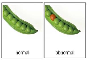 normal