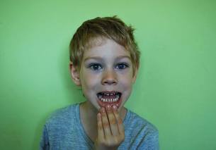 mouth