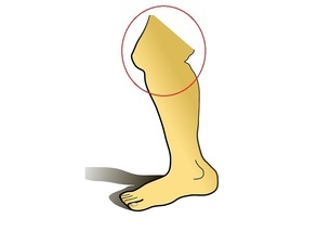 knee